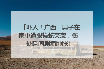 吓人！广西一男子在家中遭眼镜蛇突袭，伤处瞬间剧痛肿胀